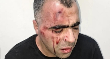 BİGACEM Başkanı Aygül’e saldırıya ilişkin 1’i polis 2 kişi gözaltına alındı